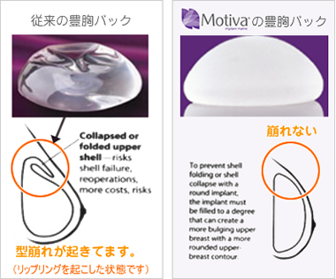 Motiva（モティバ）バッグ